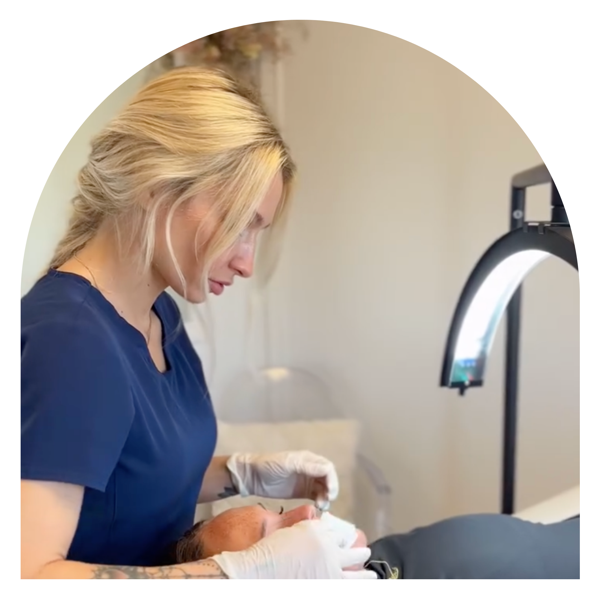 skin treatment before results Beauty Lab Winchester VA