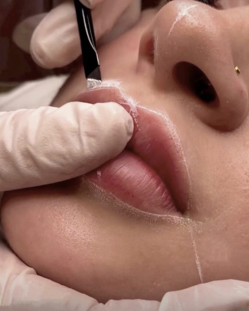 What makes a facial medical grade, Beauty Lab and Laser Center