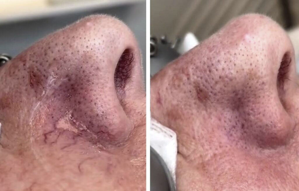 Comfort, skin reactions, and honest expectations, Beauty Lab and Laser Center